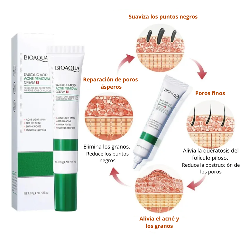 Crema Antiacné con Ácido Salicílico Bioaqua - Image 3